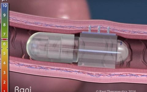 微型机器人药丸能在人体肠道内会自动注射药物