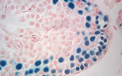 睾丸组织冷冻20年后重新植入也能制造有活力的精子